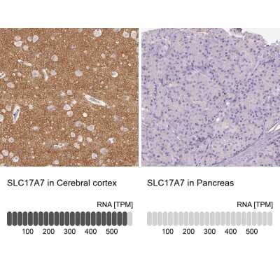 Immunohistochemistry-Paraffin: VGLUT1 Antibody [NBP2-39000]