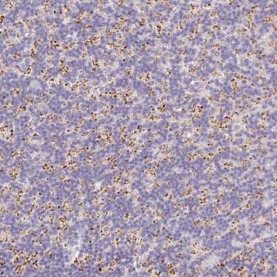 Immunohistochemistry-Paraffin: VGLUT1 Antibody [NBP2-39000]