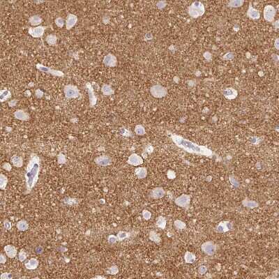 Immunohistochemistry-Paraffin: VGLUT1 Antibody [NBP2-39000]