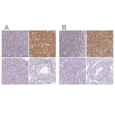 Immunohistochemistry-Paraffin: VGLUT1 Antibody [NBP2-39000]