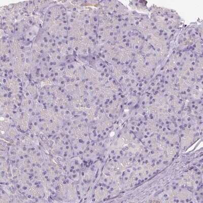 Immunohistochemistry-Paraffin: VGLUT1 Antibody [NBP2-39000]