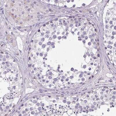 Immunohistochemistry-Paraffin: VGLUT1 Antibody [NBP2-39000]