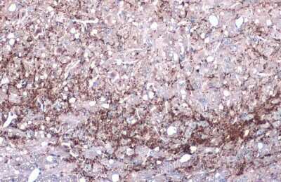 Immunohistochemistry-Paraffin: VGLUT1 Antibody [NBP3-13165]