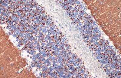Immunohistochemistry-Paraffin: VGLUT1 Antibody [NBP3-13165]
