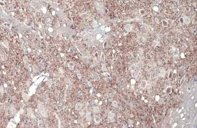 Immunohistochemistry-Paraffin: VGLUT1 Antibody [NBP3-13165]