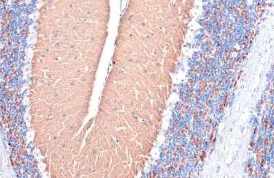 Immunohistochemistry-Paraffin: VGLUT1 Antibody [NBP3-13165]