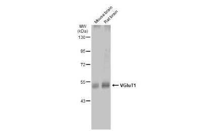 Western Blot: VGLUT1 Antibody [NBP3-13165]
