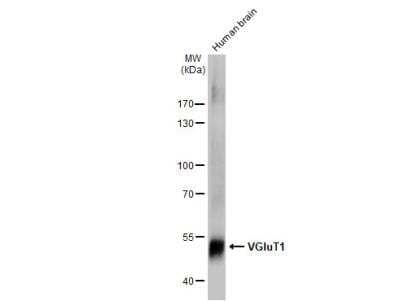 Western Blot: VGLUT1 Antibody [NBP3-13165]