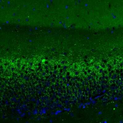 Immunohistochemistry: VGLUT2 Antibody (CL2921) [NBP2-46640]