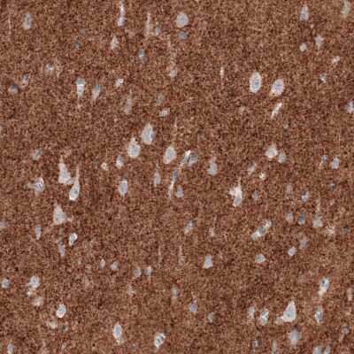 Immunohistochemistry-Paraffin: VGLUT2 Antibody (CL2921) [NBP2-46640]