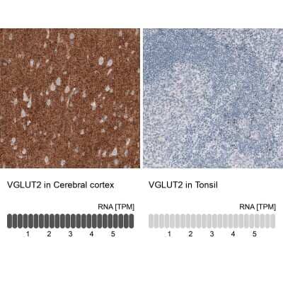 Immunohistochemistry-Paraffin: VGLUT2 Antibody (CL2921) [NBP2-46640]