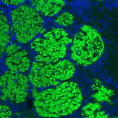 Immunohistochemistry: VGLUT2 Antibody (CL2952) [NBP2-46641]