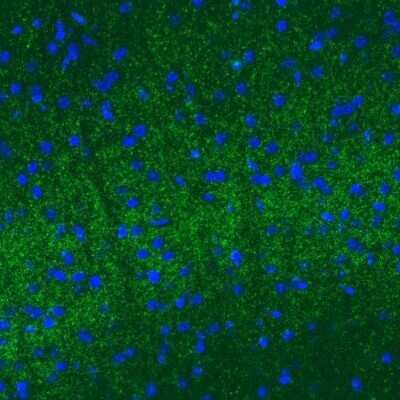 Immunohistochemistry: VGLUT2 Antibody (CL2952) [NBP2-46641]