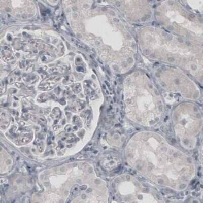 Immunohistochemistry-Paraffin: VGLUT2 Antibody (CL2952) [NBP2-46641]