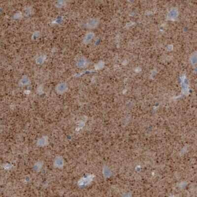 Immunohistochemistry-Paraffin: VGLUT2 Antibody (CL2952) [NBP2-46641]