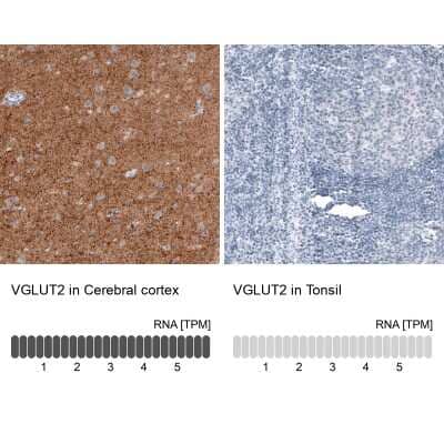 Immunohistochemistry-Paraffin: VGLUT2 Antibody (CL2952) [NBP2-46641]