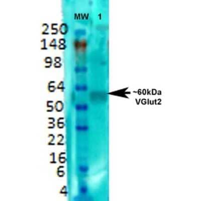 Western Blot: VGLUT2 Antibody (S29-29) [NBP2-59330]