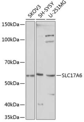 Western Blot: VGLUT2 AntibodyAzide and BSA Free [NBP2-94571]