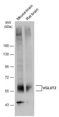 Western Blot: VGLUT2 Antibody [NBP3-13164]