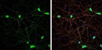 Immunocytochemistry/ Immunofluorescence: VGluT3 Antibody [NBP3-13361]