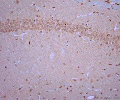 Immunohistochemistry-Paraffin: VGluT3 Antibody [NBP1-25973]