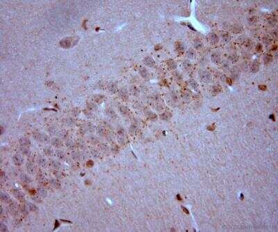 Immunohistochemistry-Paraffin: VGluT3 Antibody [NBP1-25973]