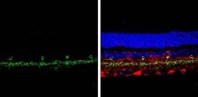 Immunohistochemistry-Paraffin: VGluT3 Antibody [NBP3-13183]