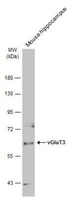 Western Blot: VGluT3 Antibody [NBP3-13361]