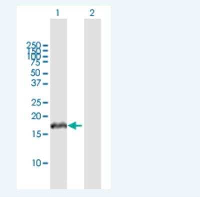 Western Blot: VHLL Antibody [H00391104-B01P-50ug]