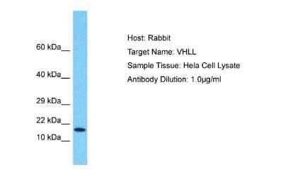 Western Blot: VHLL Antibody [NBP2-84330]