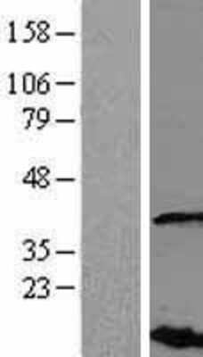 Western Blot: VHLL Overexpression Lysate [NBL1-17720]