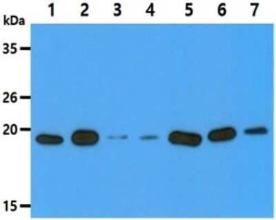 Western Blot: VHR/DUSP3 Antibody (9E6)BSA Free [NBP2-59460]