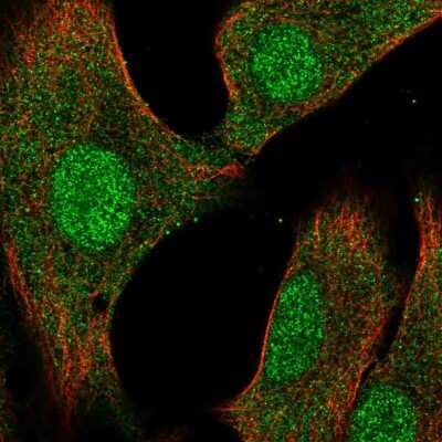 Immunocytochemistry/ Immunofluorescence: VHR/DUSP3 Antibody [NBP2-57387]