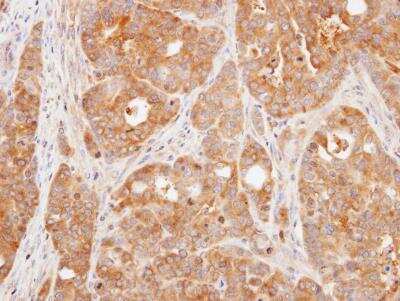 Immunohistochemistry-Paraffin: VHR/DUSP3 Antibody [NBP1-33099]