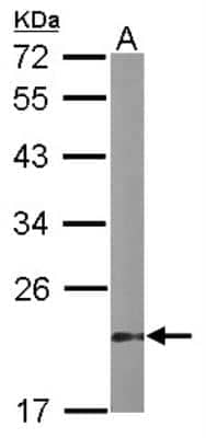 Western Blot: VHR/DUSP3 Antibody [NBP1-33099]