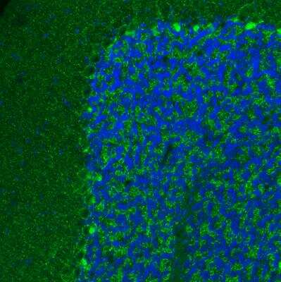 Immunohistochemistry: VIAAT/SLC32A1/VGAT Antibody (CL2793) [NBP2-46628]