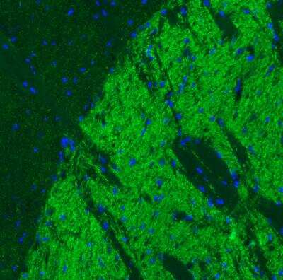 Immunohistochemistry: VIAAT/SLC32A1/VGAT Antibody (CL2793) [NBP2-46628]