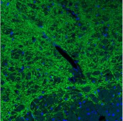 Immunohistochemistry: VIAAT/SLC32A1/VGAT Antibody (CL2793) [NBP2-46628]