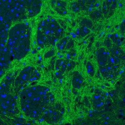 Immunohistochemistry: VIAAT/SLC32A1/VGAT Antibody (CL2793) [NBP2-46628]