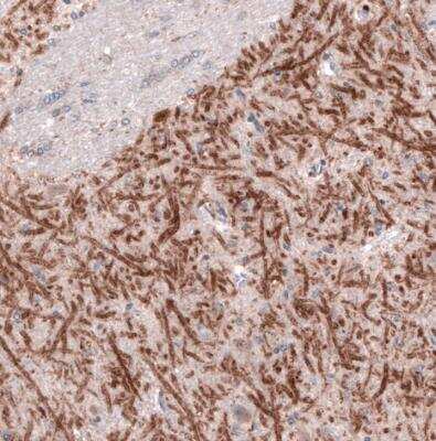 Immunohistochemistry-Paraffin: VIAAT/SLC32A1/VGAT Antibody (CL2793) [NBP2-46628]