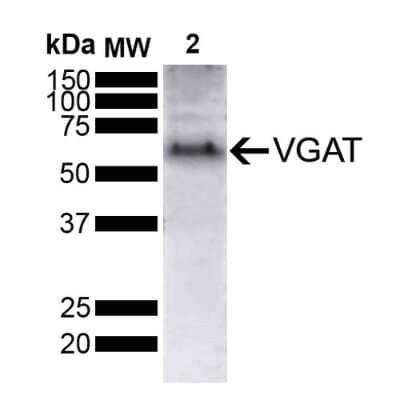 Western Blot: VIAAT/SLC32A1/VGAT Antibody (D9) [NBP2-79823]