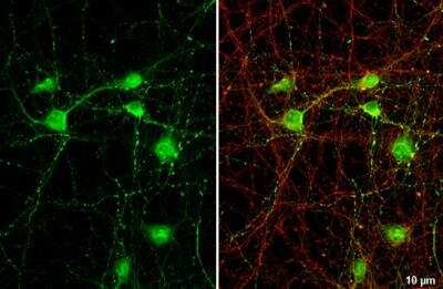 Immunocytochemistry/ Immunofluorescence: VIAAT/SLC32A1/VGAT Antibody [NBP2-20857]