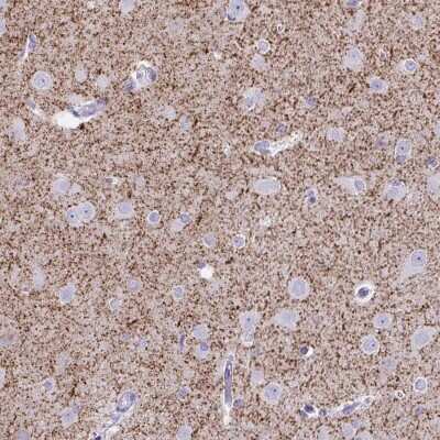 Immunohistochemistry-Paraffin: VIAAT/SLC32A1/VGAT Antibody [NBP2-34117]