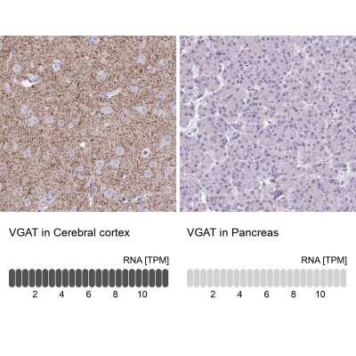 Immunohistochemistry-Paraffin: VIAAT/SLC32A1/VGAT Antibody [NBP2-34117]