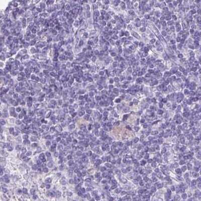 Immunohistochemistry-Paraffin: VIAAT/SLC32A1/VGAT Antibody [NBP2-34117]