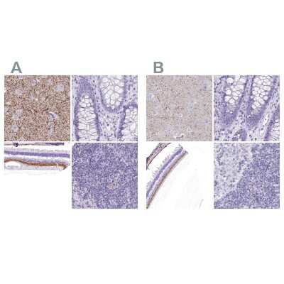 Immunohistochemistry-Paraffin: VIAAT/SLC32A1/VGAT Antibody [NBP2-34117]