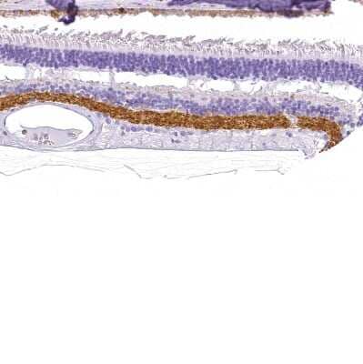 Immunohistochemistry-Paraffin: VIAAT/SLC32A1/VGAT Antibody [NBP2-34117]