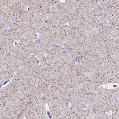 Immunohistochemistry-Paraffin: VIAAT/SLC32A1/VGAT Antibody [NBP2-34131]