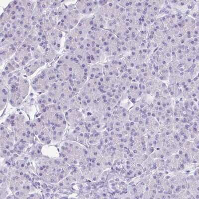 Immunohistochemistry-Paraffin: VIAAT/SLC32A1/VGAT Antibody [NBP2-34131]