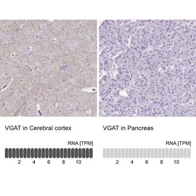 Immunohistochemistry-Paraffin: VIAAT/SLC32A1/VGAT Antibody [NBP2-34131]